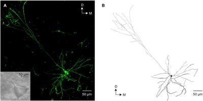 Refinement of Active and Passive Membrane Properties of Layer V Pyramidal Neurons in Rat Primary Motor Cortex During Postnatal Development